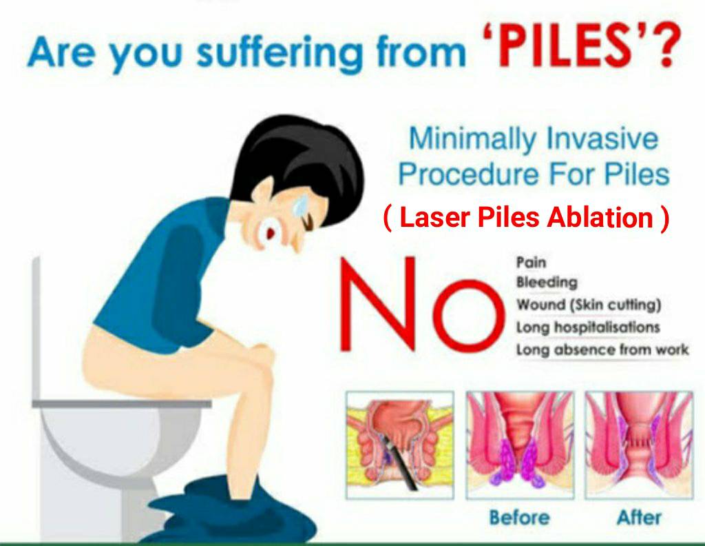 Benefits of Laser main image