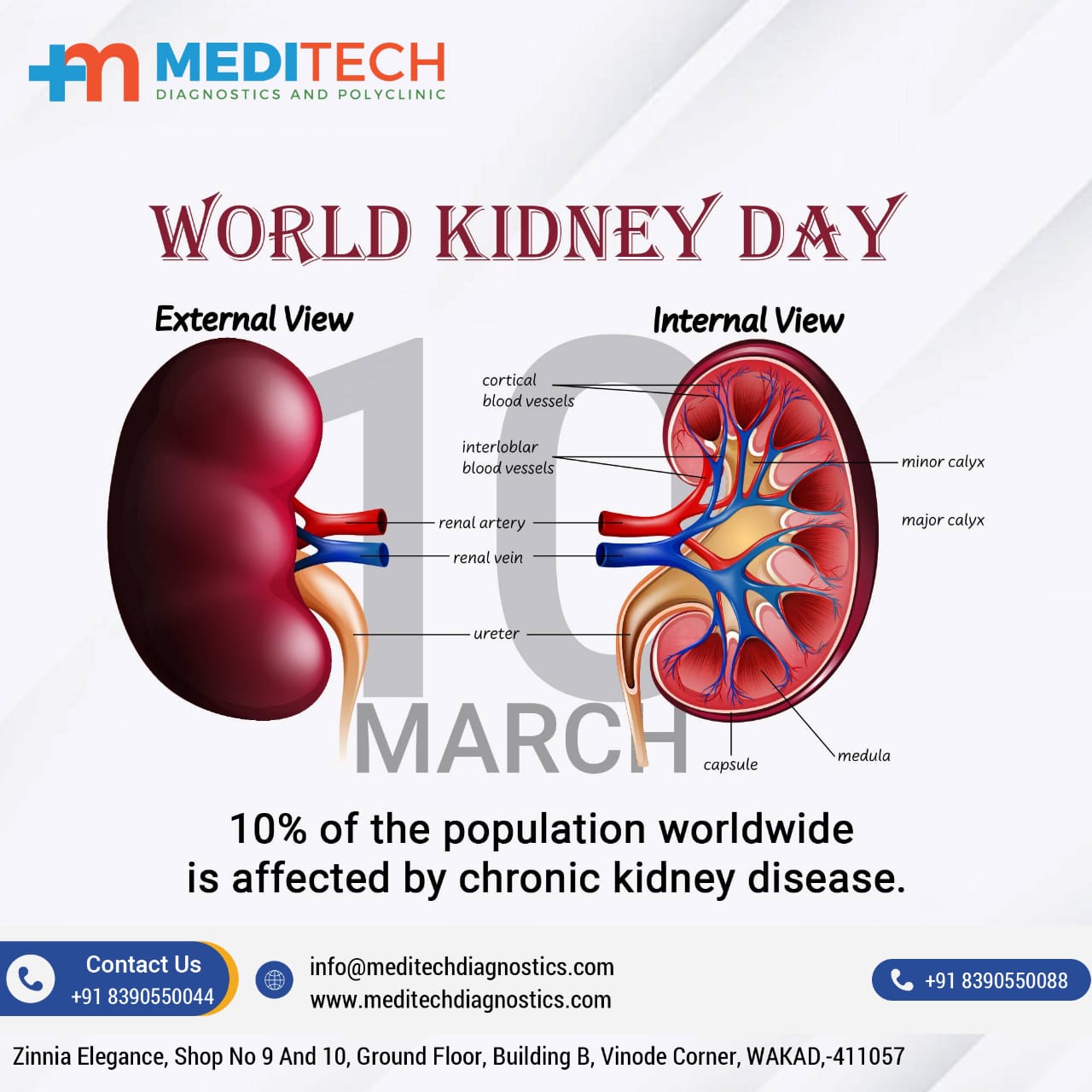 WORLD KIDNEY DAY! Contact us for any Kidney Diseas... main image