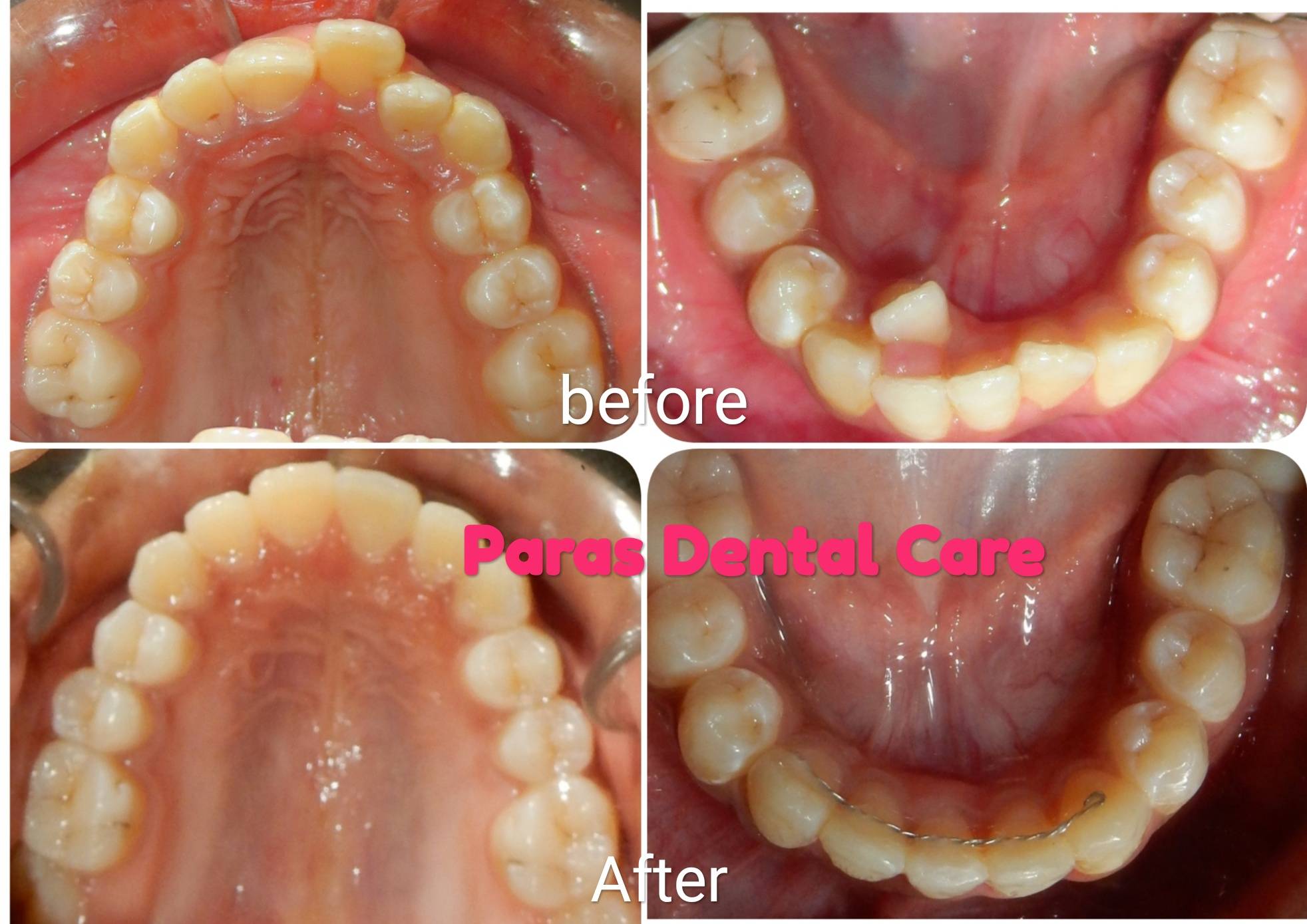 Patient came with a chief complaint of irregula... main image