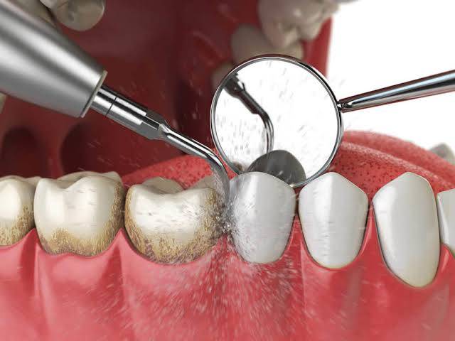 Taking care of your teeth requires more than re... main image