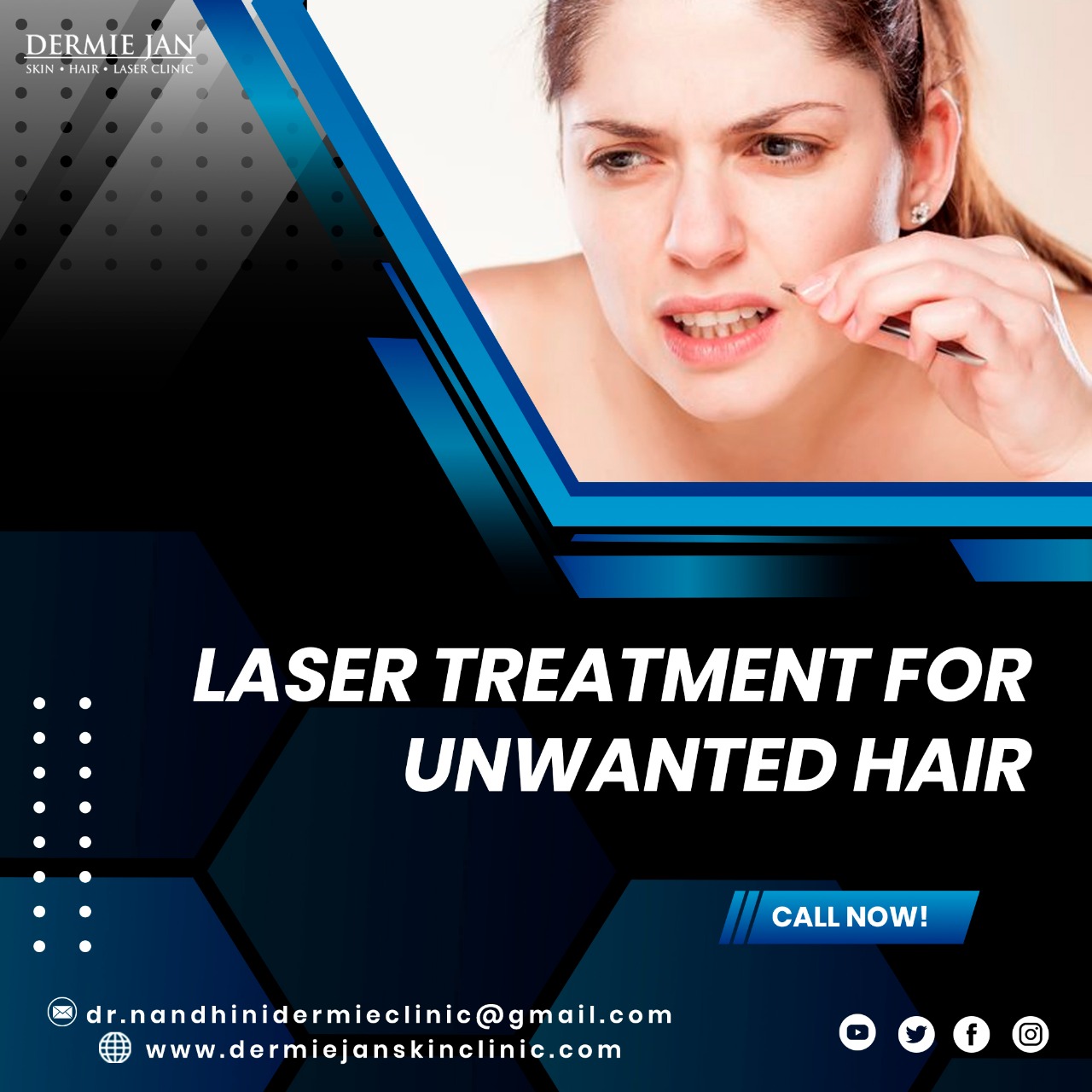 Laser treatment for unwanted hair/ How to remove unwanted hair/ Best