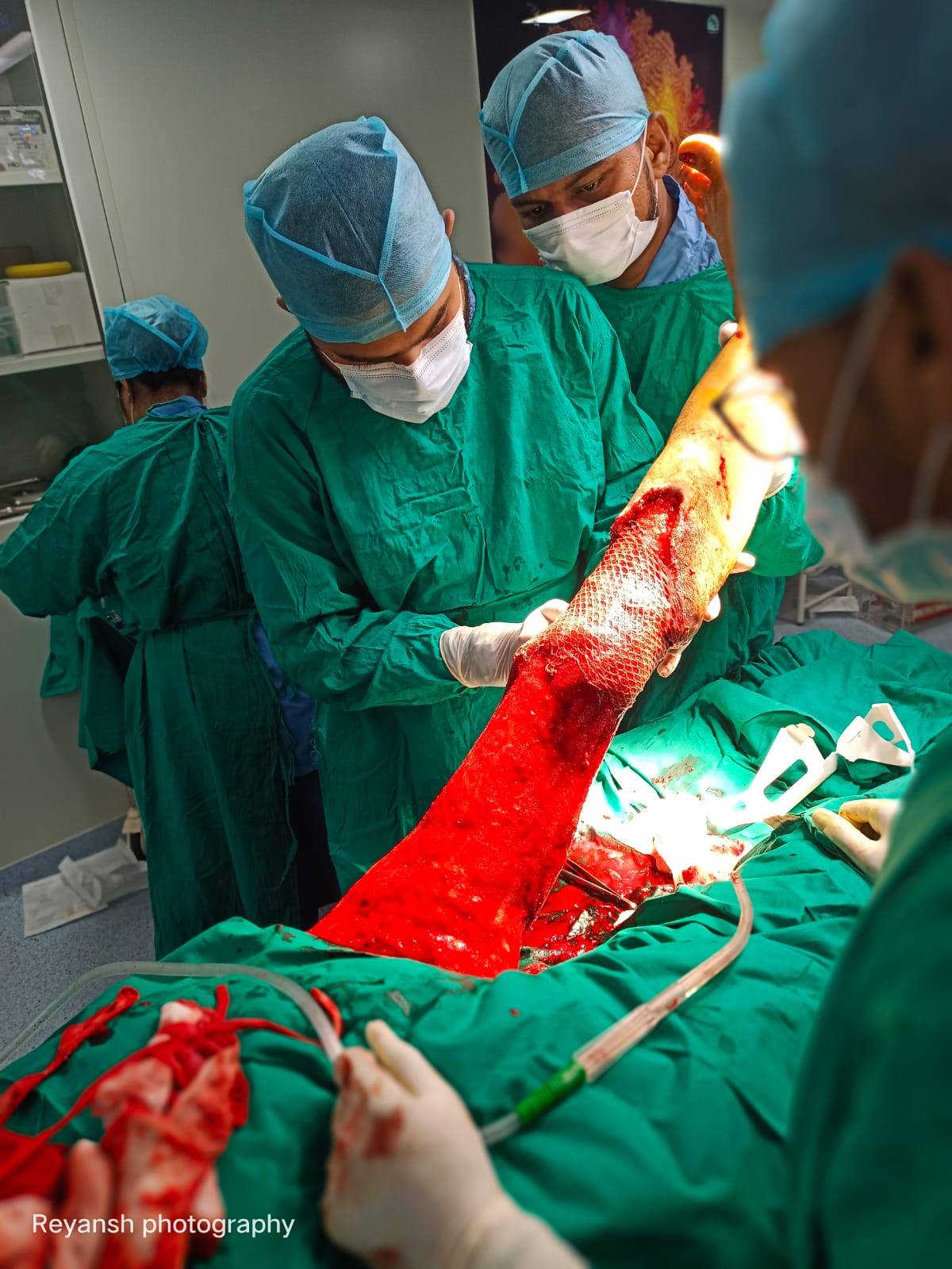Skin Grafting At Car