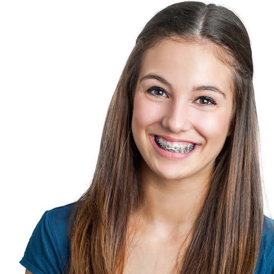 Aligning the jaw and teeth with braces or align... main image