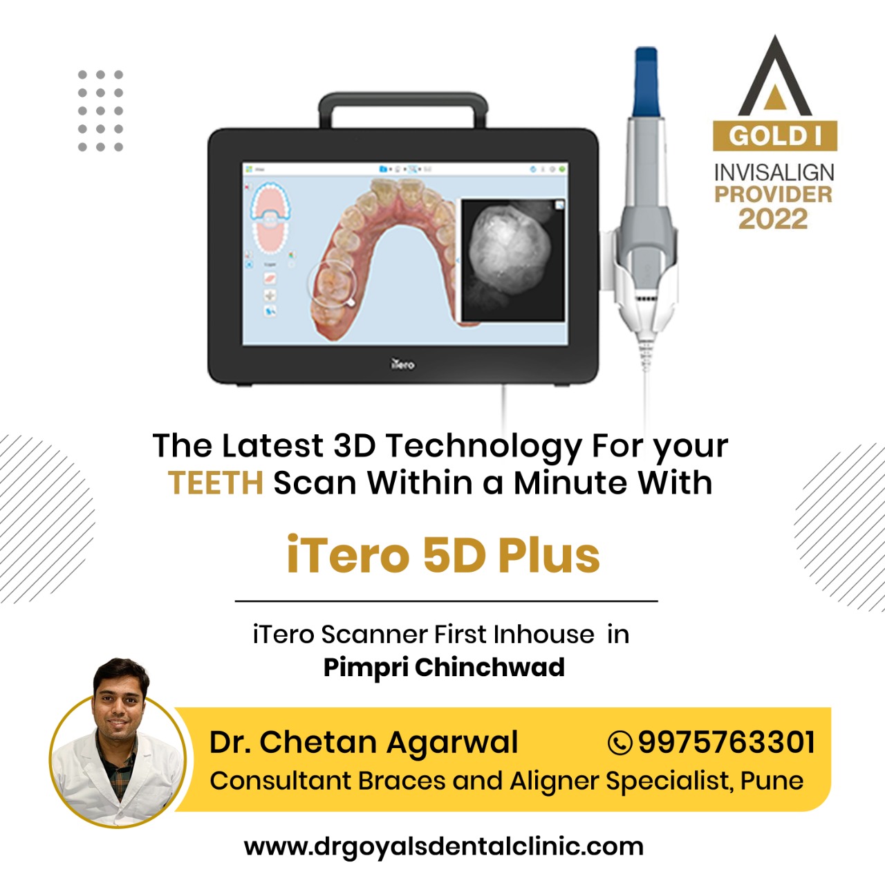 The iTero Element 5D+ imaging system is an excelle... main image