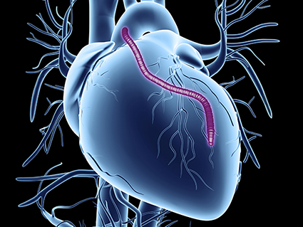 Finding Cardiac Surgeon in PCMC? Bypass Surgeon... main image