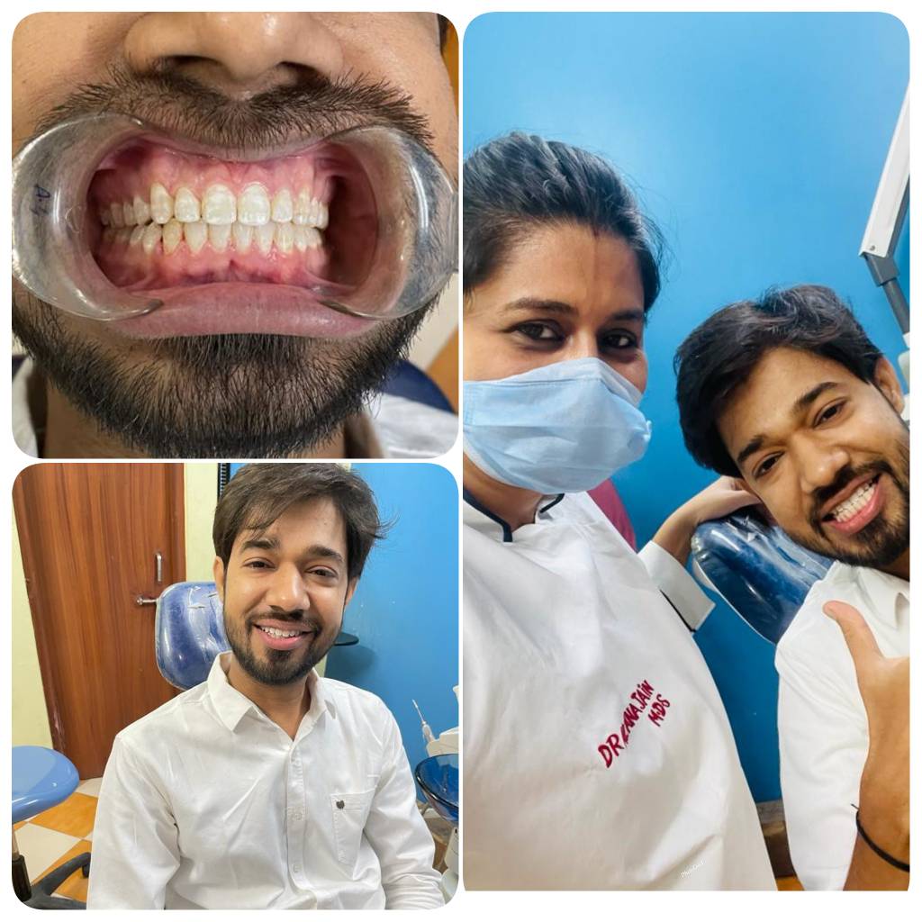 Happy patient after removal of braces. We alway... main image