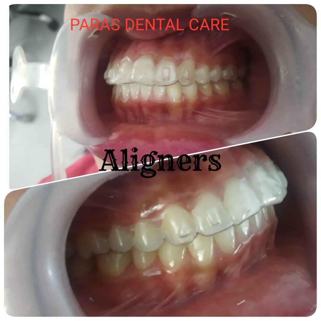We love your smile !
Lets make it great…
Remove... main image