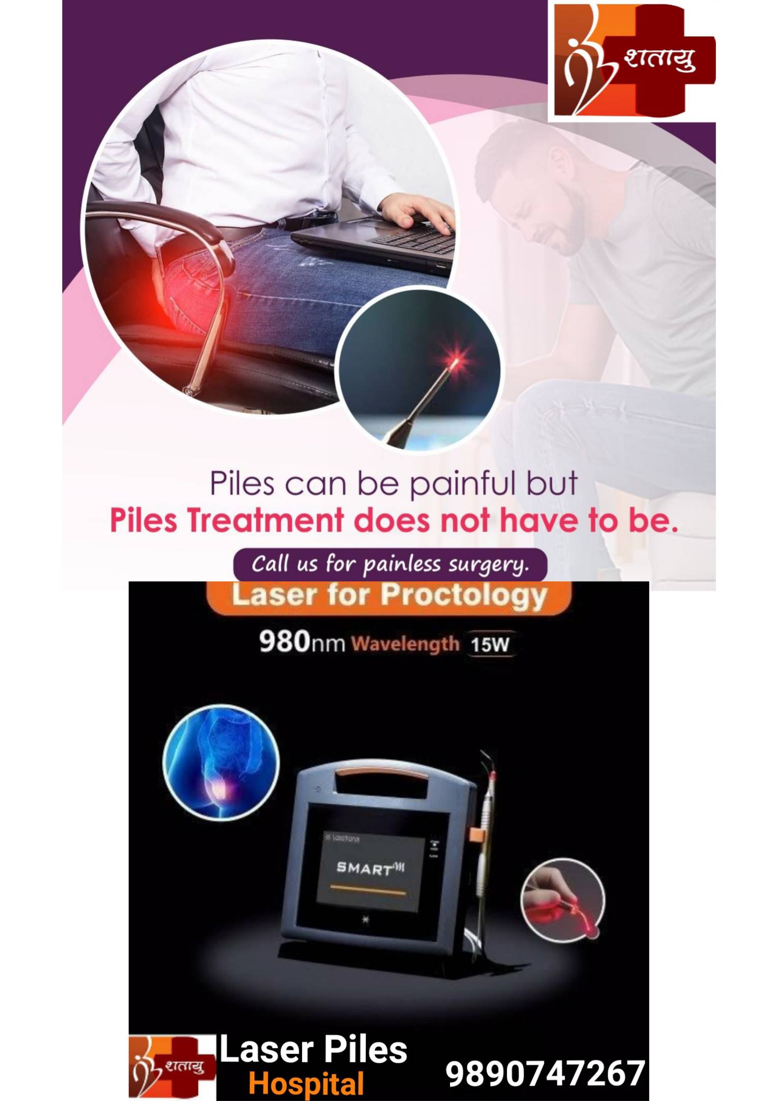 Advace Laser Treatment at afordable price main image