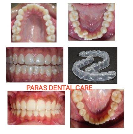 Invisible braces provide an esthetic and comfor... main image