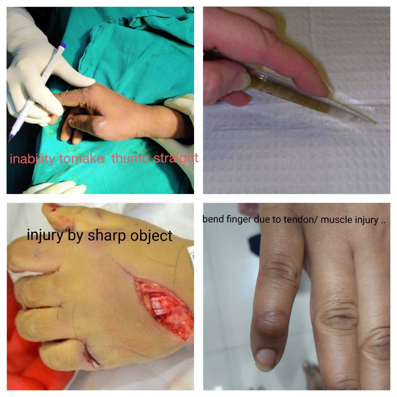 Do not neglect injury by sharp objects. It can ... main image