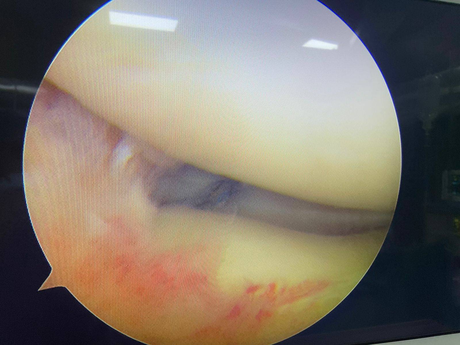 Orthopedic surgeon in Aundh 
Best treatment for me... main image