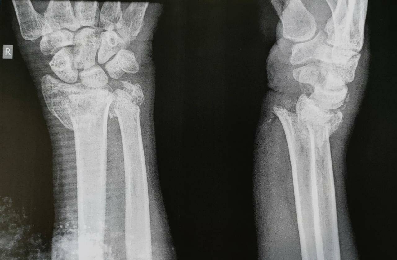 Best orthopedic hospitals in Aundh
Hand and wri... main image