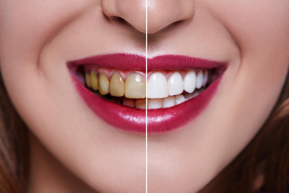Do you want to visit Visit Teeth Whitening Clin... main image