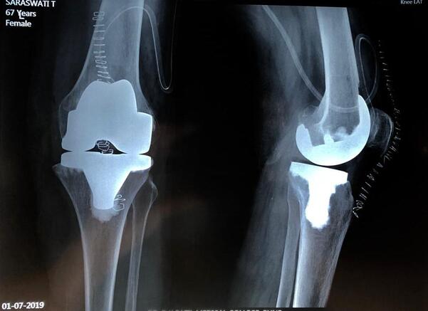 Best orthopedic hospitals
Hand and wrist traum... main image