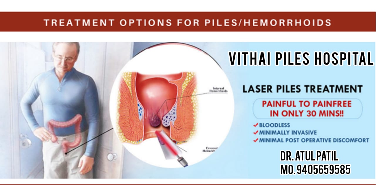 Piles are swollen veins in and around the anus area that may occur due
