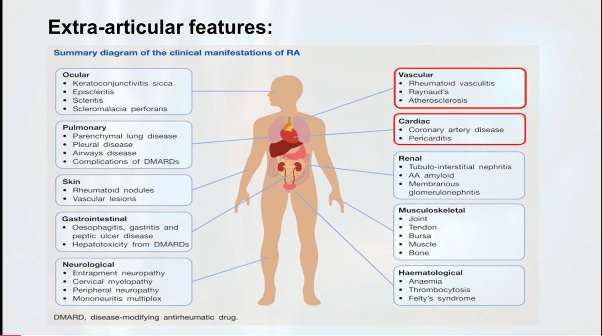 Rheumatoid arthritis is a condition affecting youn... main image