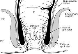 Treatment of Fistula,  
Bhagandar :-

There’s n... main image