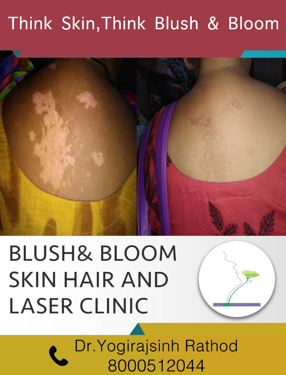 Think_Skin_Think_Blush_& _Bloom skin_specialist_in... main image