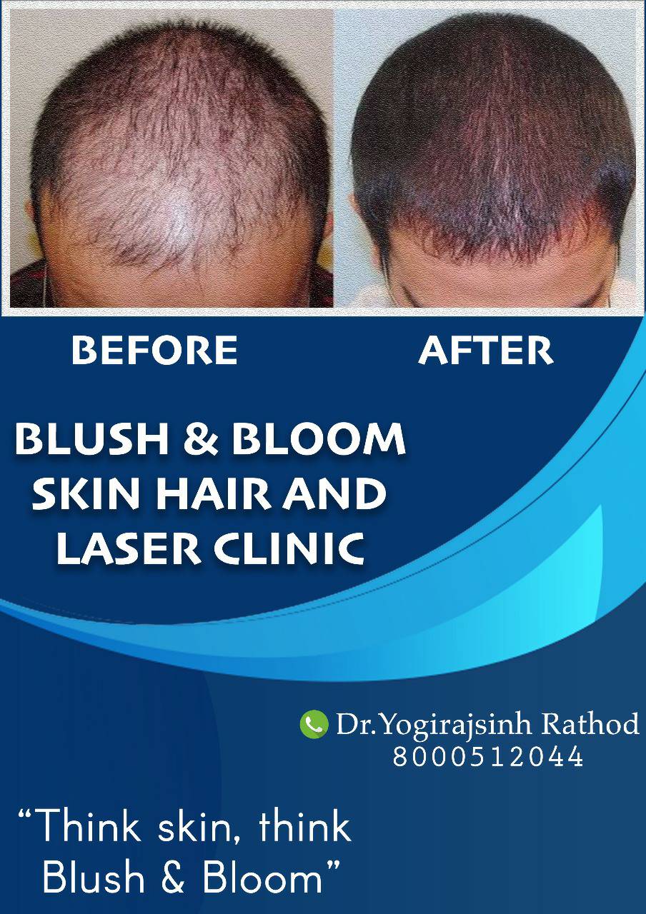 Think_Skin_Think_Blush_& _Bloom skin_specialist_in... main image