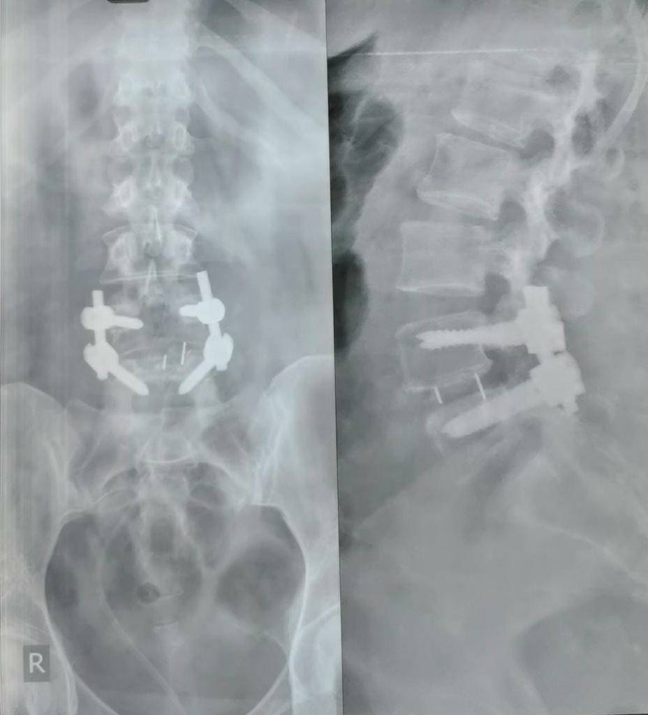 Low back pain ?
Donot ignore.
Get yourself chec... main image