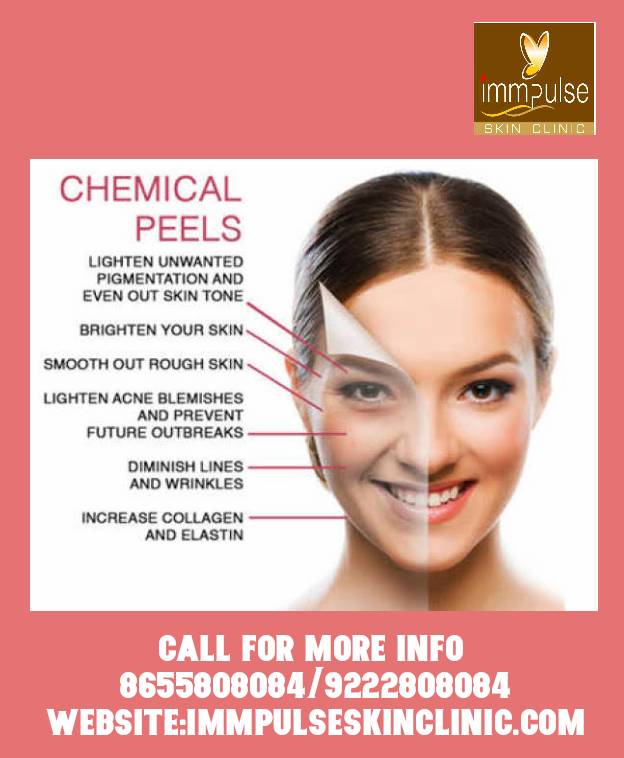 Peels treatment 
At immpulse skin clinic
Suits all... main image