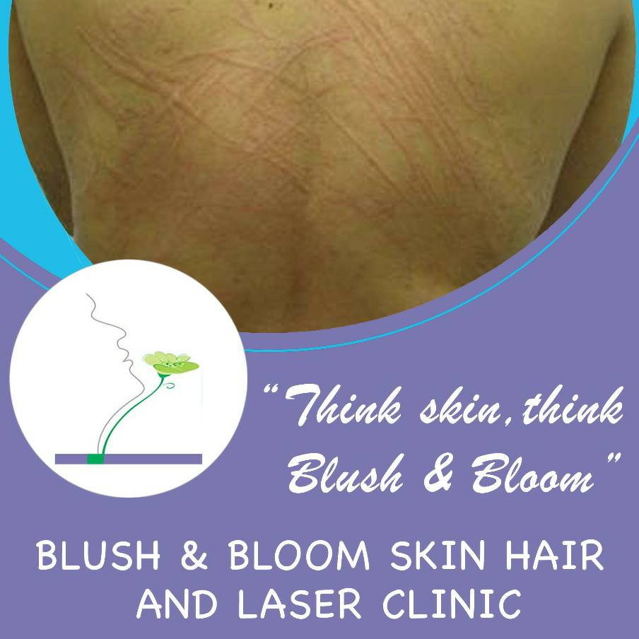 Think_Skin_Think_Blush_& _Bloom skin_specialist_in... main image