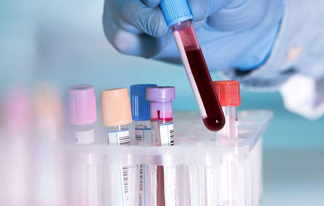 Are you Looking for Pathology Lab in Ravet, PCM... main image