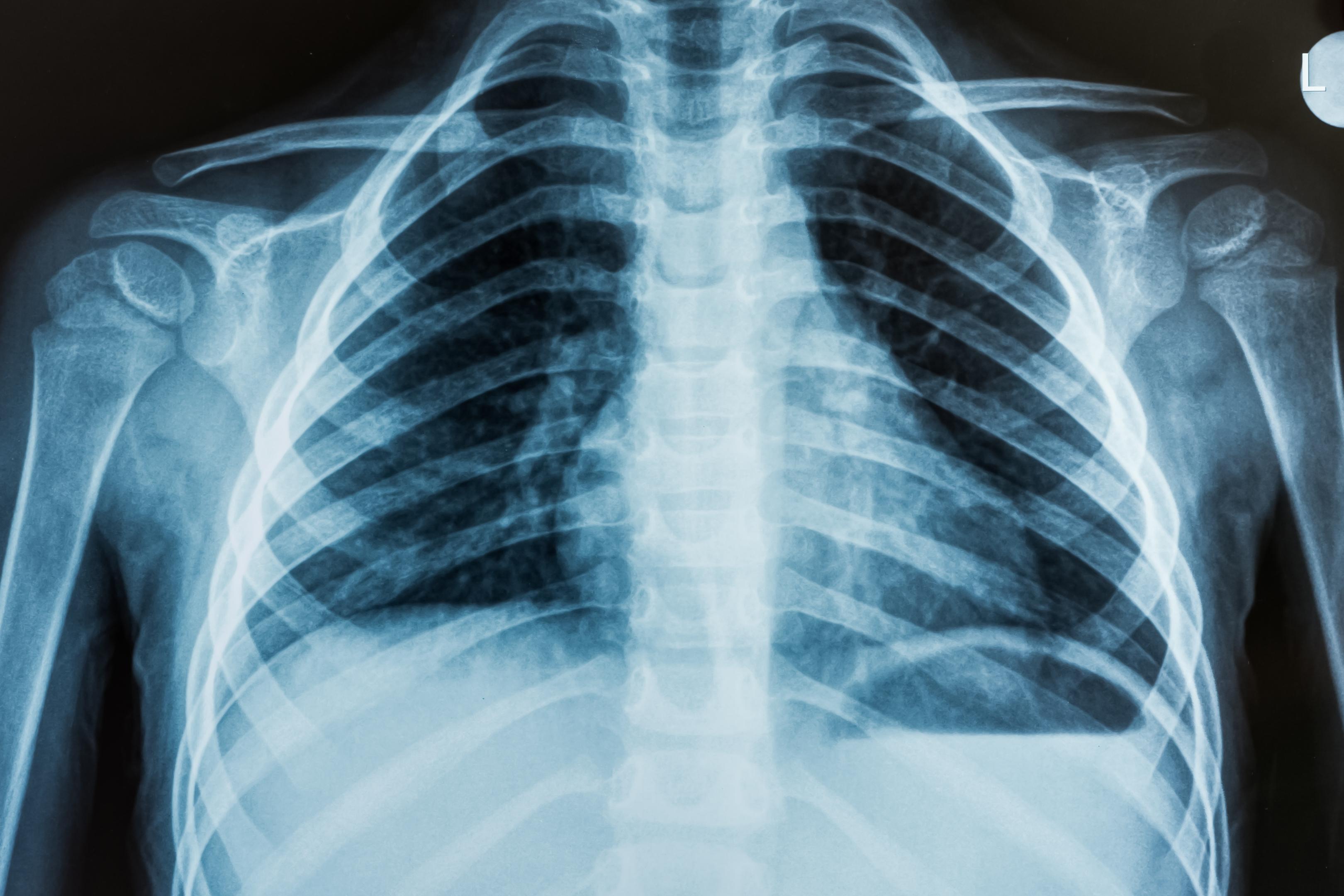 Are you Finding X Ray Centre in Ravet, PCMC? Di... main image
