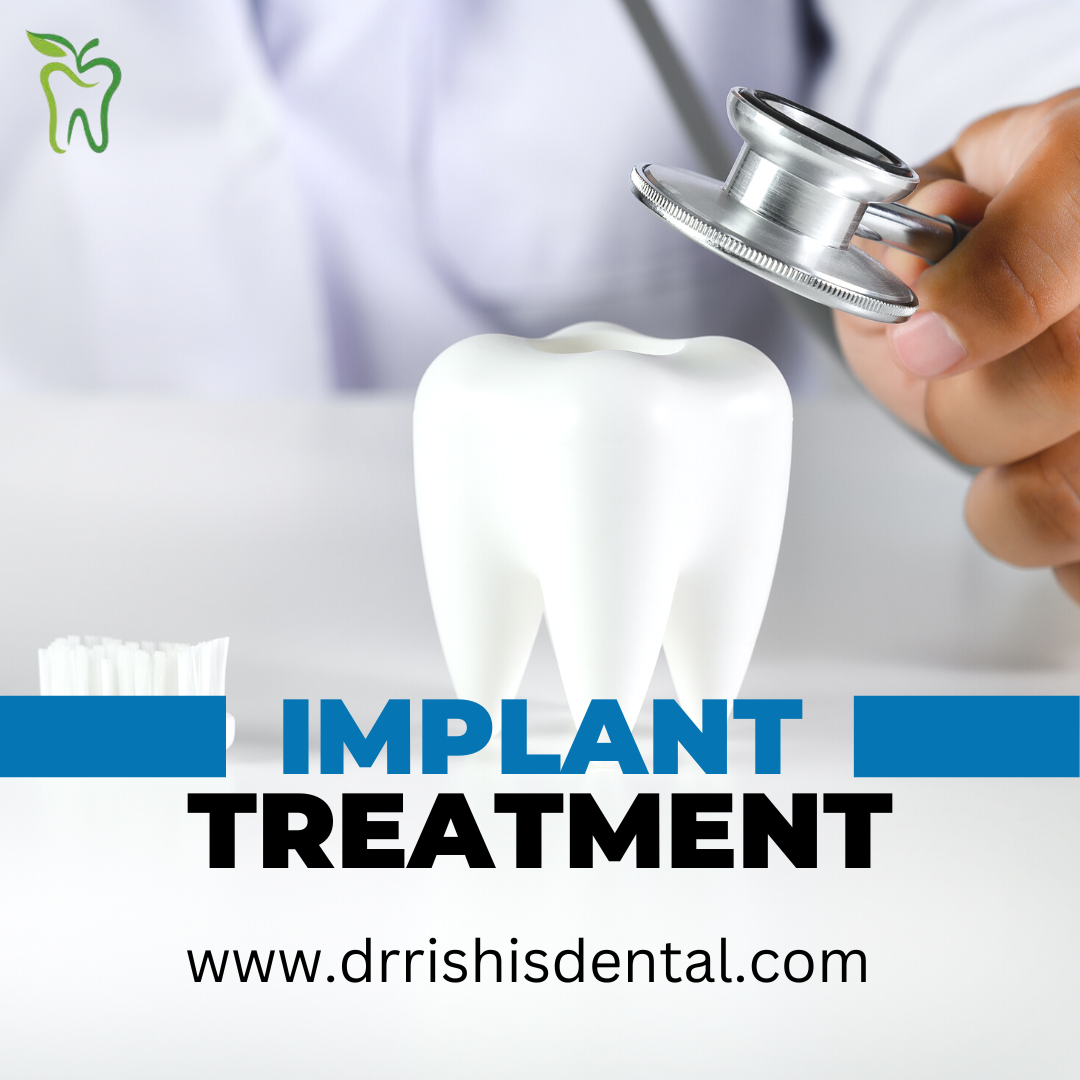 IMPLANT DENTIST
Get your missing teeth replaced... main image
