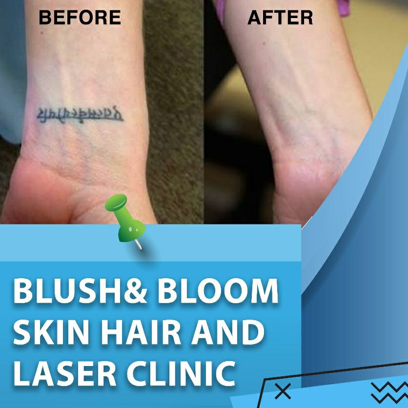 Think_Skin_Think_Blush_& _Bloom skin_specialist... main image