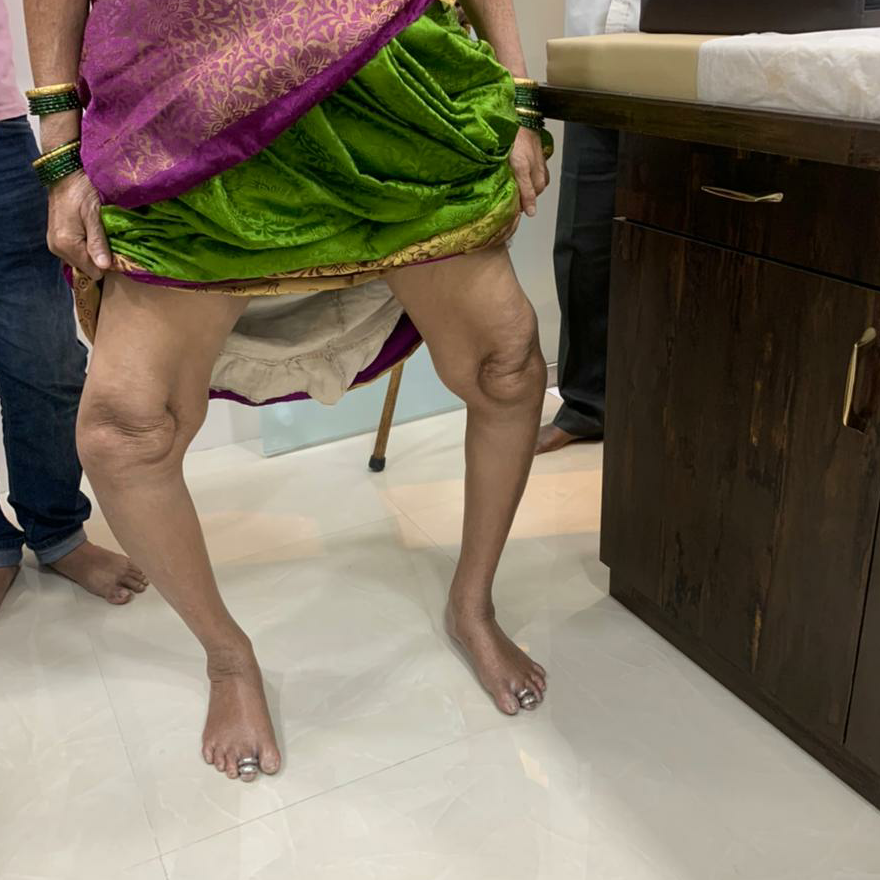 knee pain ?
Get yourself checked and treated by... main image