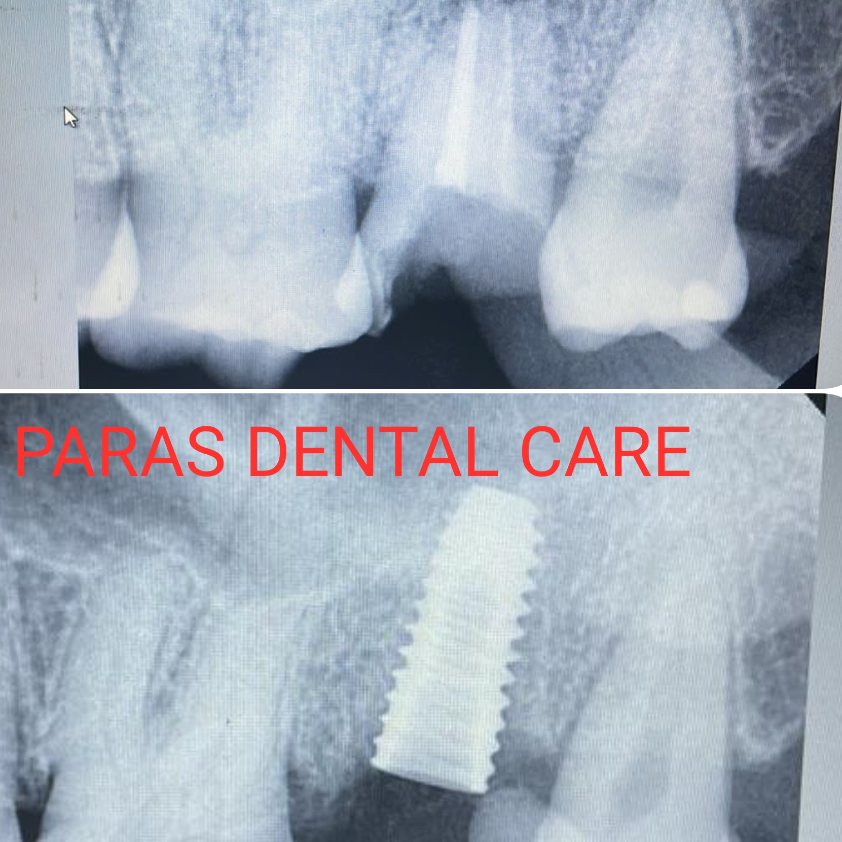 Patient came with a complaint of pain in upper bac... main image