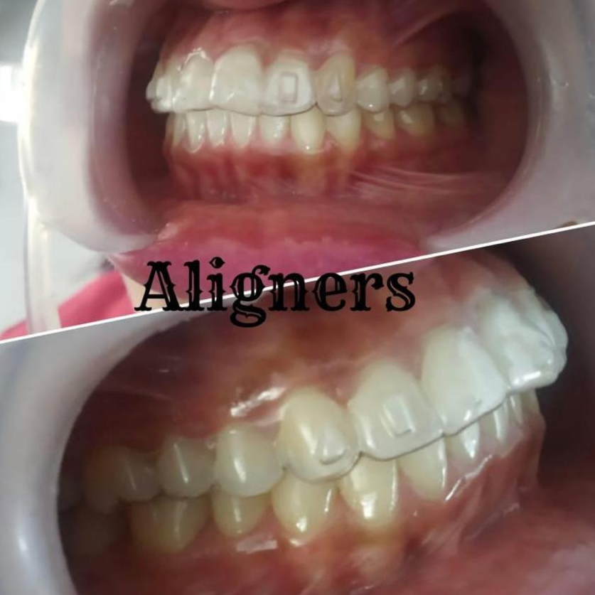 We are excited to get you the best smile you deser... main image