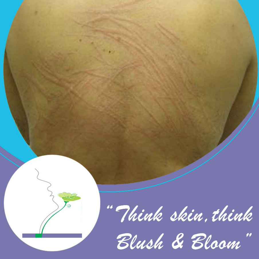 Think_Skin_Think_Blush_& _Bloom skin_specialist_in... main image