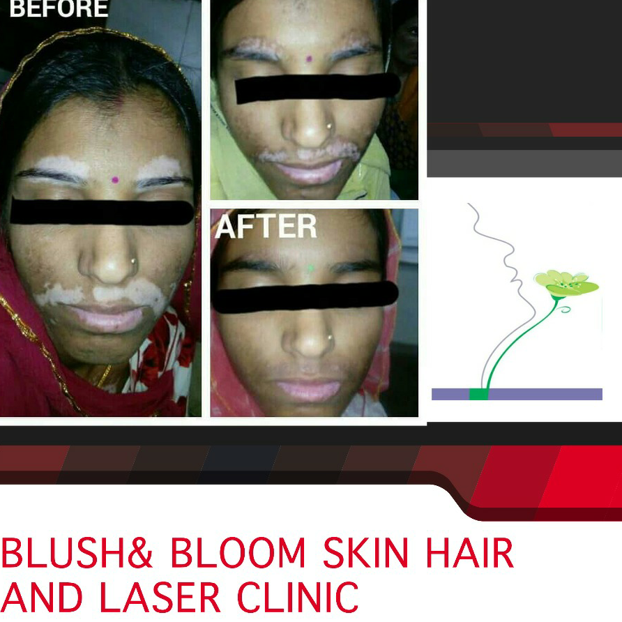 Think_Skin_Think_Blush_& _Bloom skin_specialist_in... main image