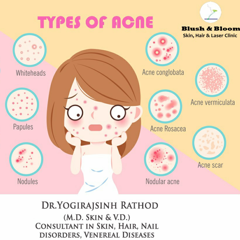 Think_Skin_Think_Blush_& _Bloom skin_specialist... main image