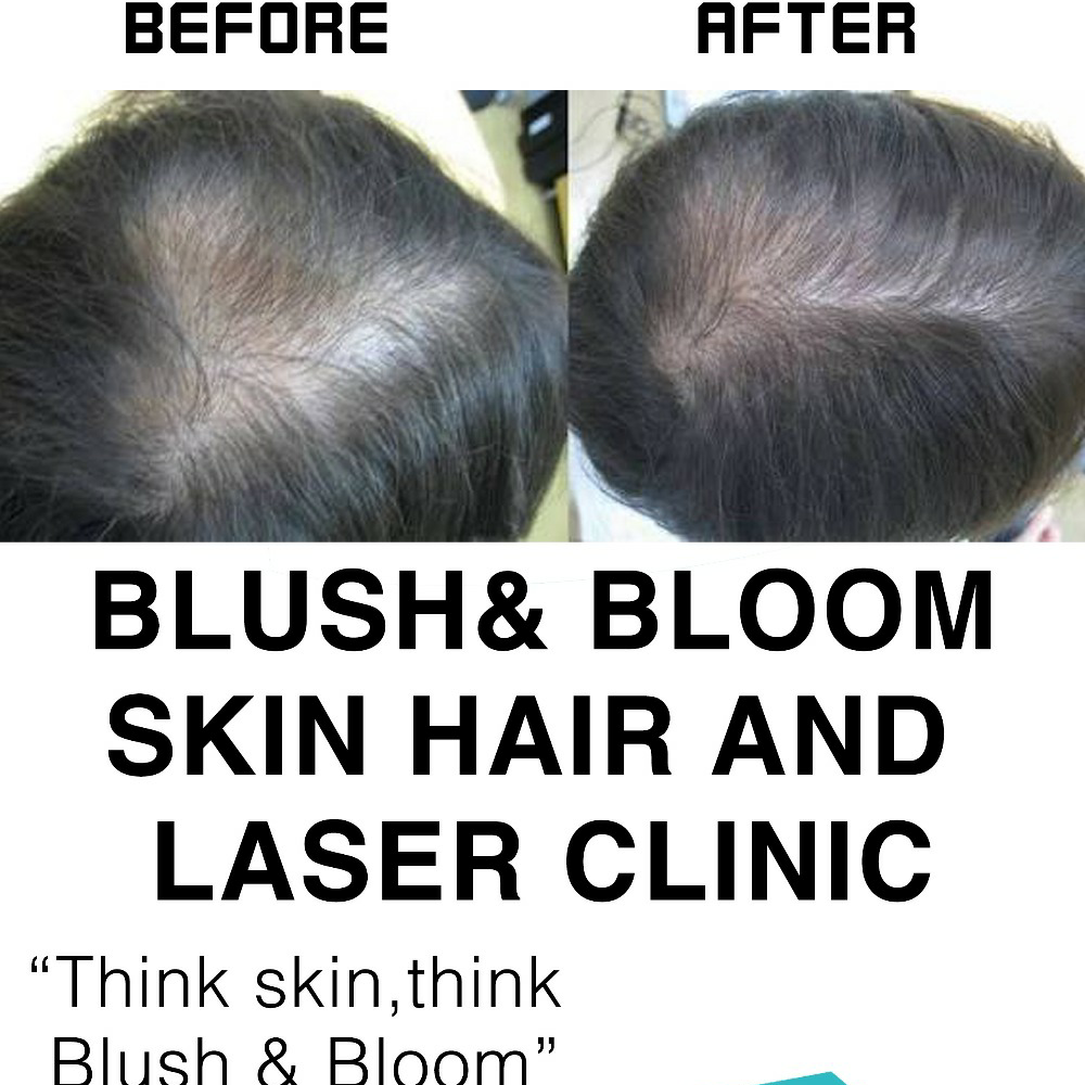 Think_Skin_Think_Blush_& _Bloom skin_specialist... main image