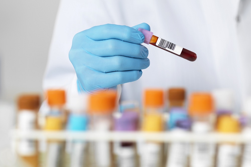 Searching Blood Test Centre in Ravet, Kiwale, P... main image