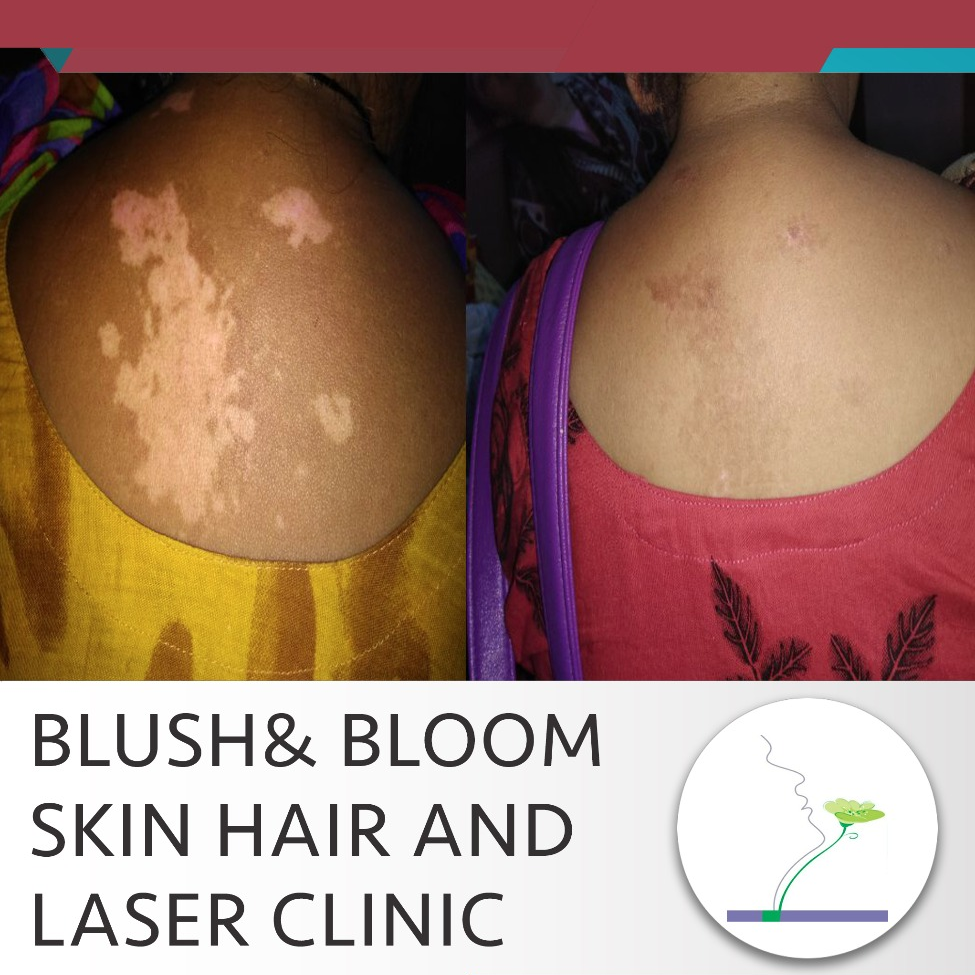 Think_Skin_Think_Blush_& _Bloom skin_specialist... main image