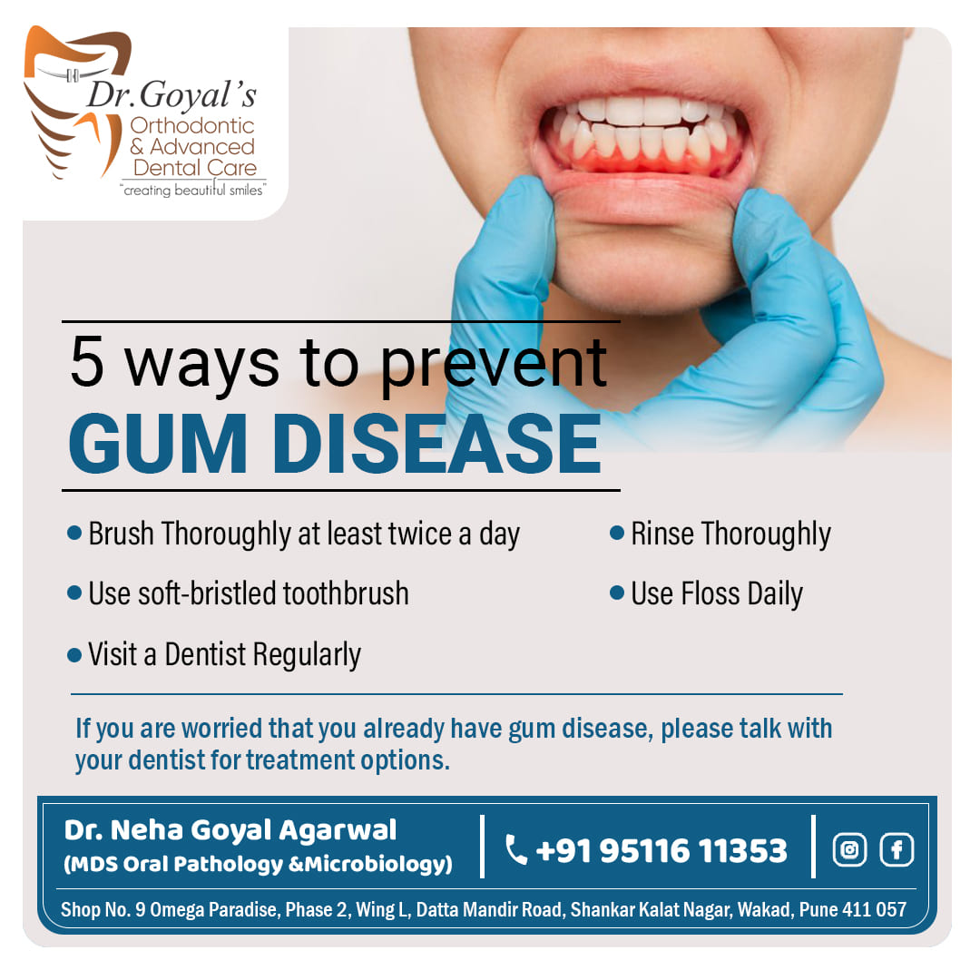 Gum disease is a serious issue that can lead to... main image