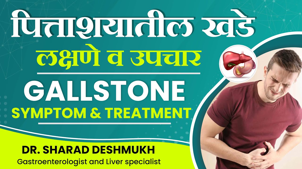पित्ताशयातील खडे लक्षणे व उपचार - Gallstone Sym... main image