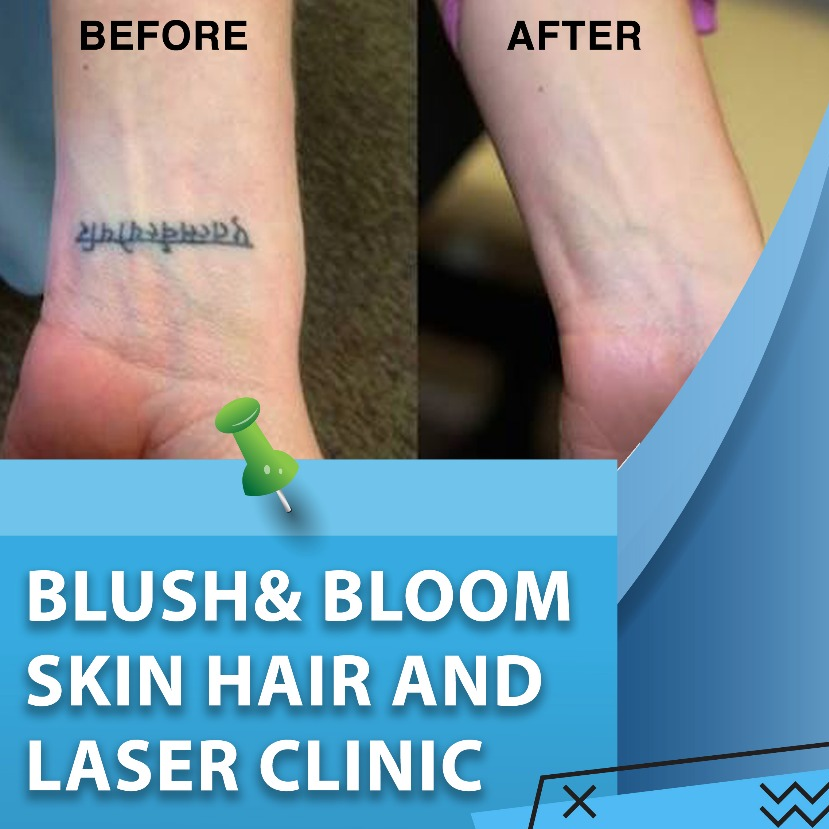 Think_Skin_Think_Blush_& _Bloom skin_specialist... main image