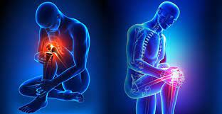Replacement arthroplasty, or joint replacement ... main image