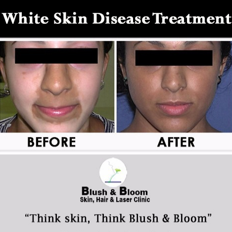 Think_Skin_Think_Blush_& _Bloom skin_specialist_in... main image