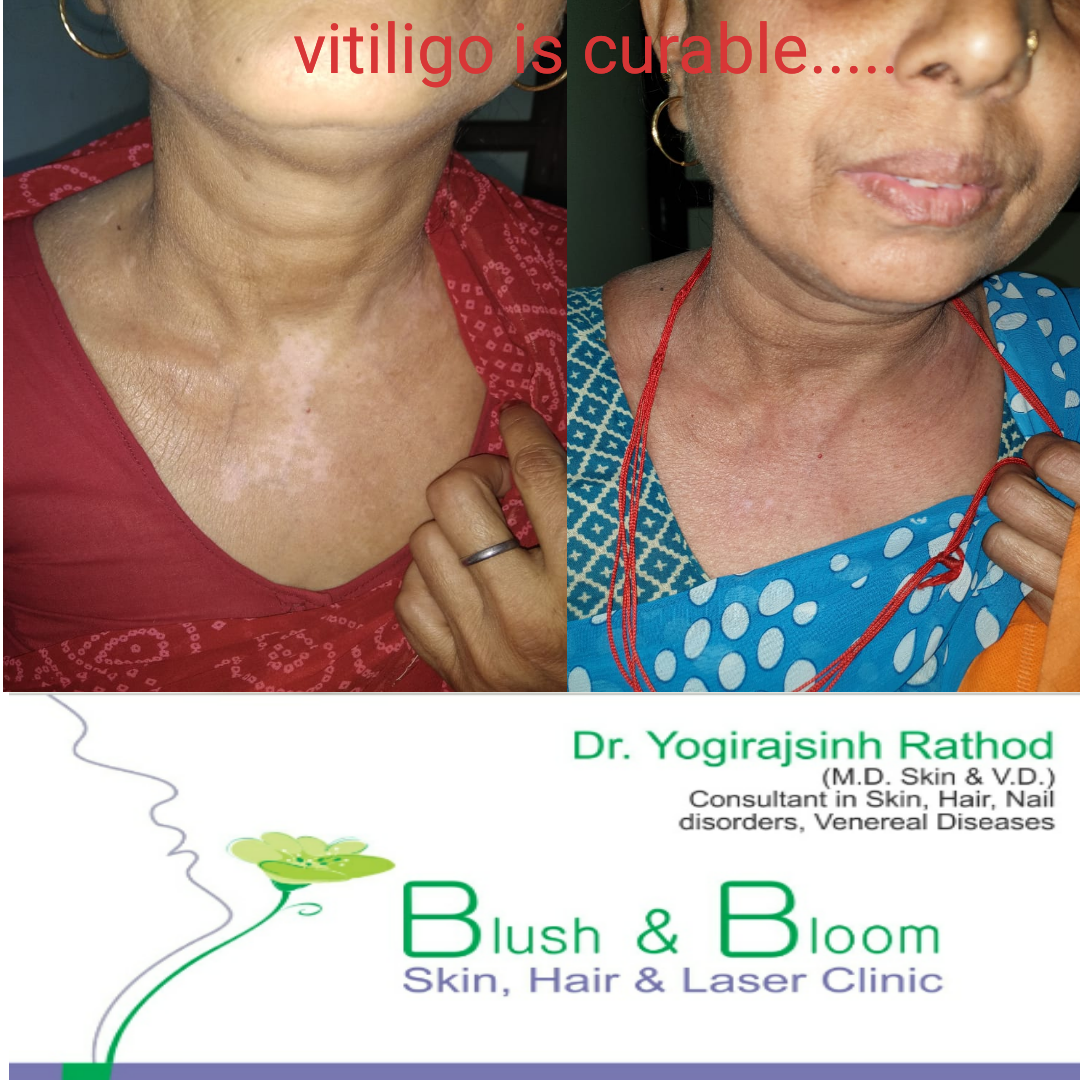 Think_Skin_Think_Blush_& _Bloom skin_specialist... main image