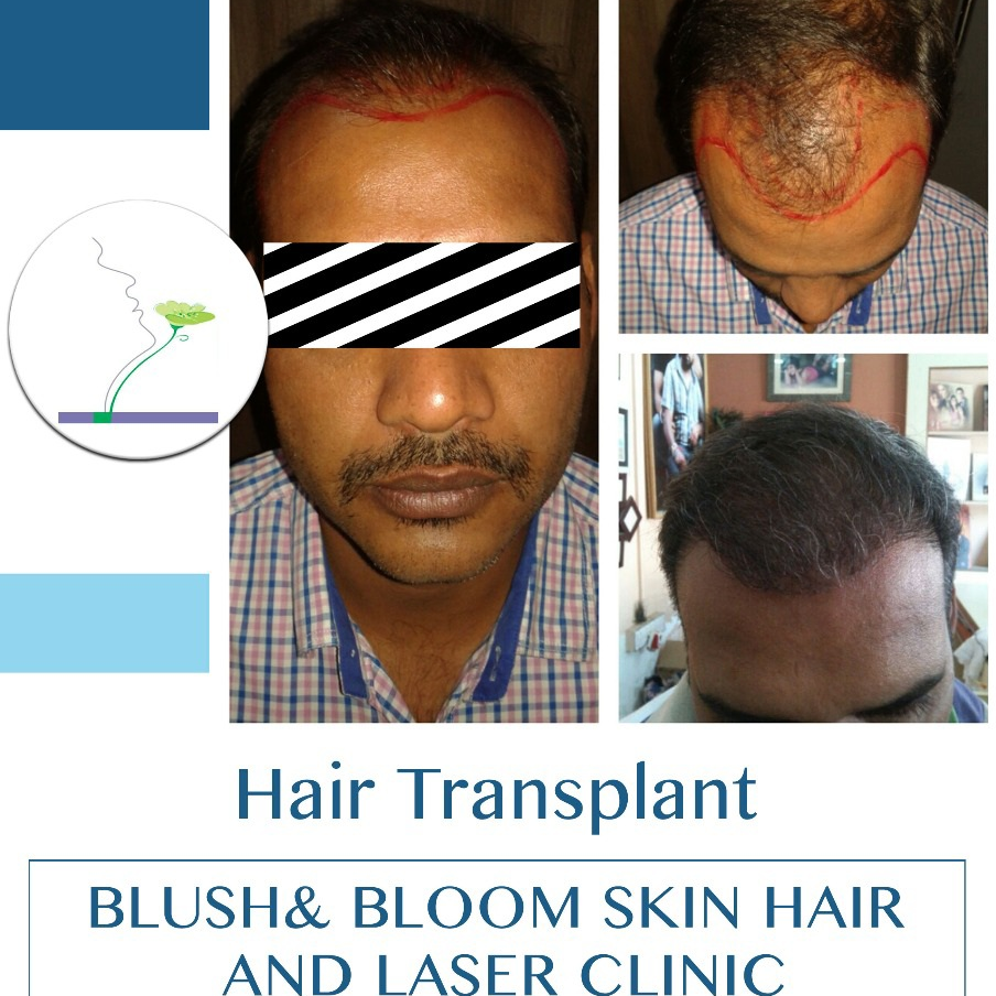 Think_Skin_Think_Blush_& _Bloom skin_specialist... main image