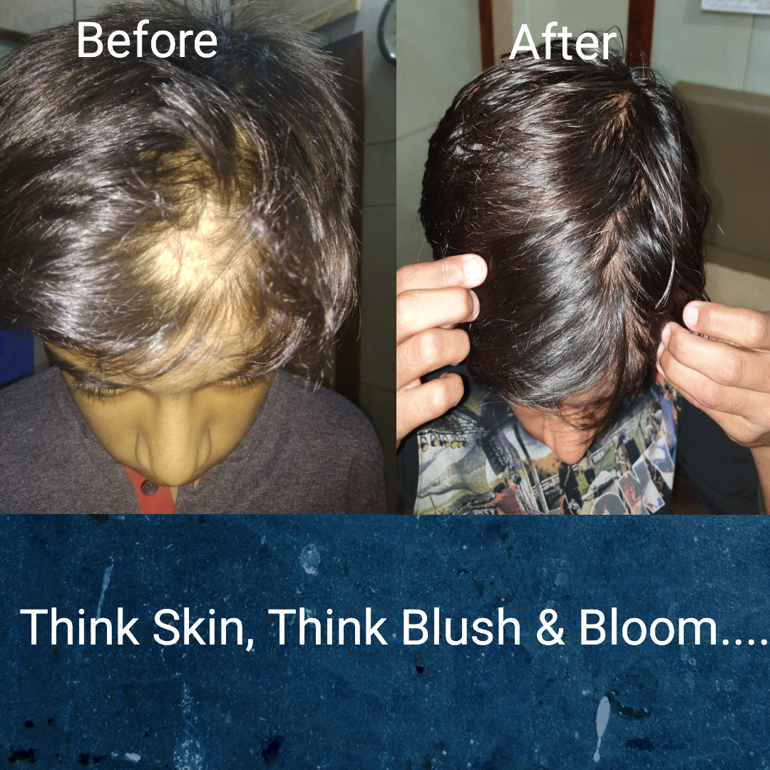 Think_Skin_Think_Blush_& _Bloom skin_specialist... main image