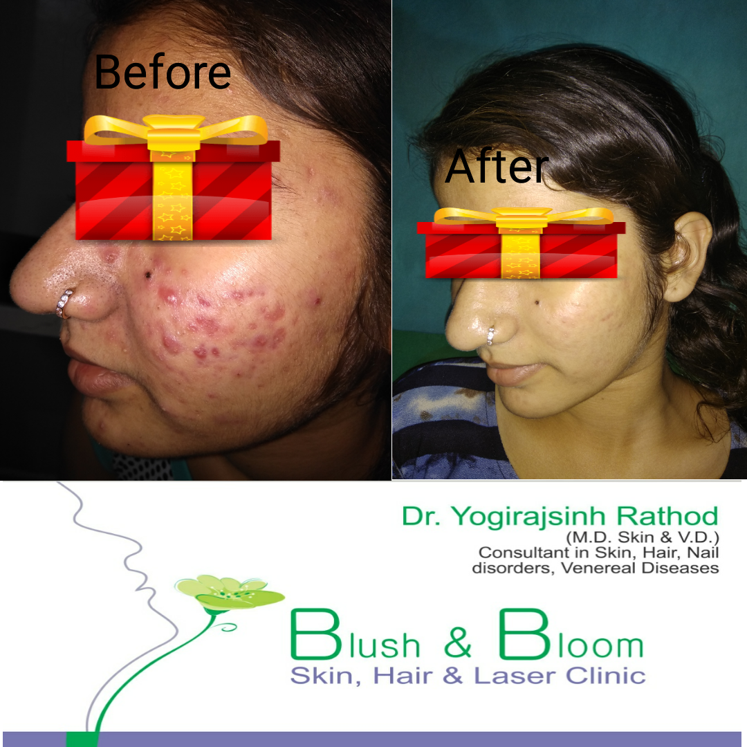 Think_Skin_Think_Blush_& _Bloom skin_specialist... main image