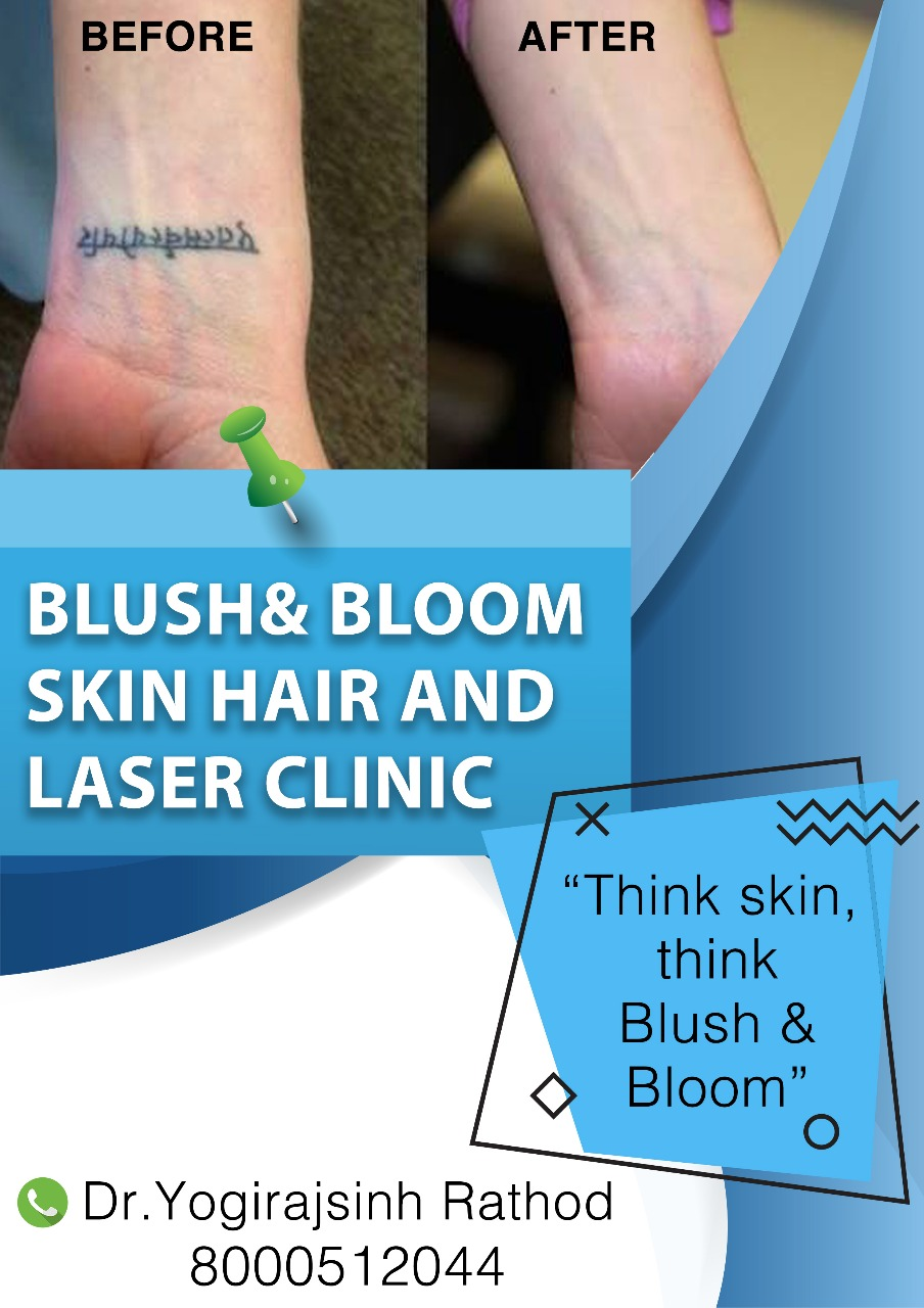 #Think_Skin_Think_Blush_& _Bloom #skin_speciali... main image