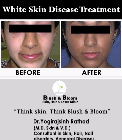 Think_Skin_Think_Blush_& _Bloom skin_specialist... main image